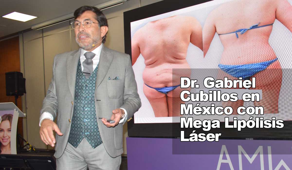 Dr. Cubillos ahora en México con Mega Lipólisis Láser para adelgazar